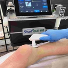 450KHZ Tecar Therapy Machine 2 In 1 Shockwave Erectile Therapy กายภาพบำบัดฟื้นฟูสมรรถภาพ