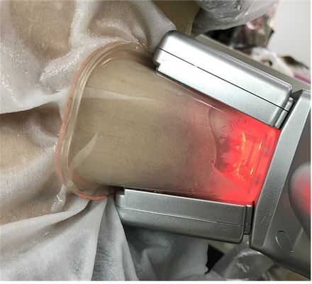 เครื่องแช่แข็งไขมัน Cryolipolysis แบบช่องคู่สำหรับการลดเซลลูไลท์