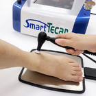 เครื่องกายภาพบำบัด Smart Tecar Therapy สำหรับอาการปวดกระดูกสันหลัง