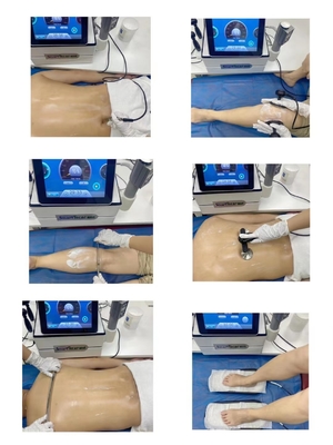 แบบพกพาสูญญากาศ EMS Shockwave Tecar เครื่องบำบัดสำหรับผิวหน้า/หย่อนสมรรถภาพทางเพศ/บรรเทาอาการปวด/ฟื้นฟู