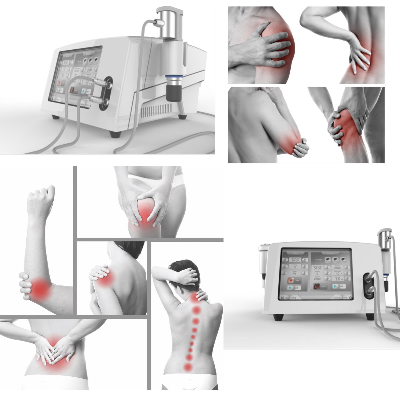 เครื่องกายภาพบำบัดอัลตราโซนิก Shockwave ความดันอากาศสำหรับการฟื้นฟูสมรรถภาพกีฬา